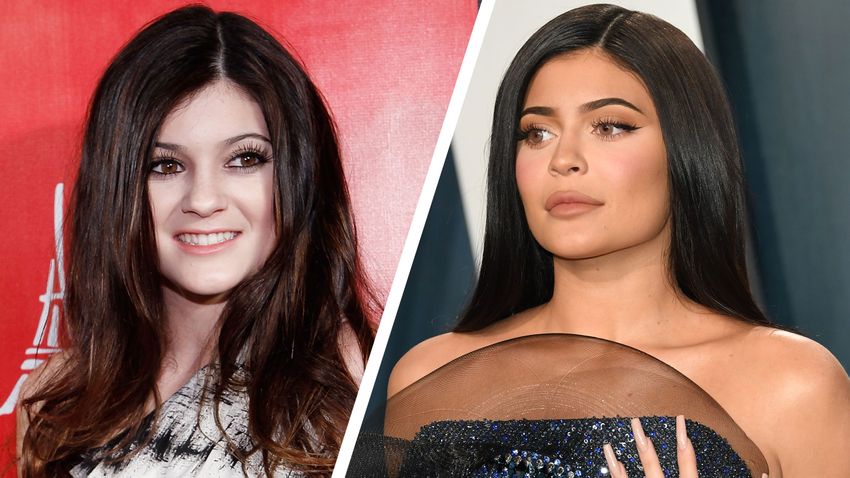 Kylie Jenner - Before and After